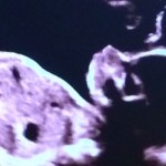 The truth about being pregnant